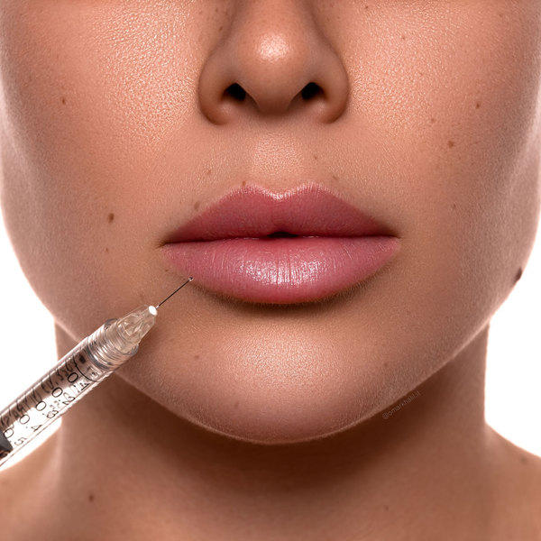 FILLER LABBRA MILANO PROMOZIONE BLACK FRIDAY